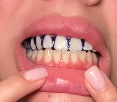 — Priya S., Los Angeles CA